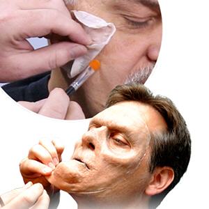 Adhésifs prothétiques